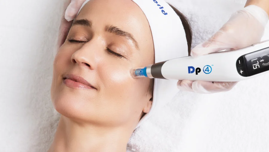 Skin Needling or Micro Needting